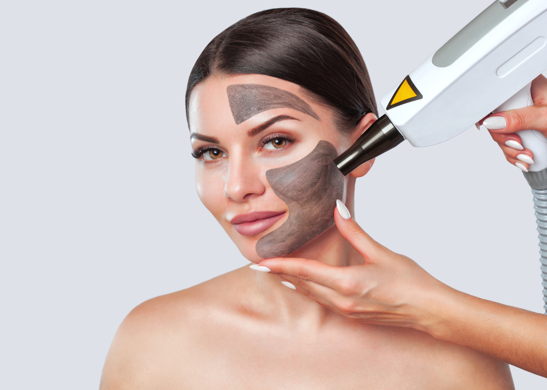 Laser Treatments